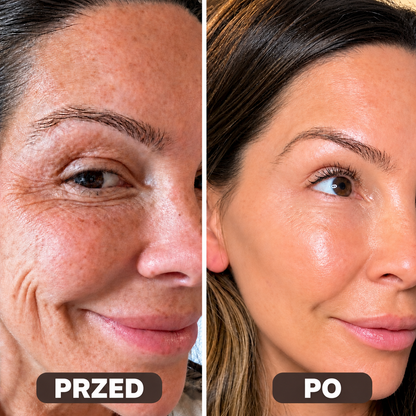 Collagen Volume Balm – Na zmarszczki i zwiotczałą skórę