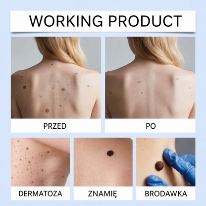 ClearRoller™ Serum z kulką roll-on – zaawansowane dla czystej skóry